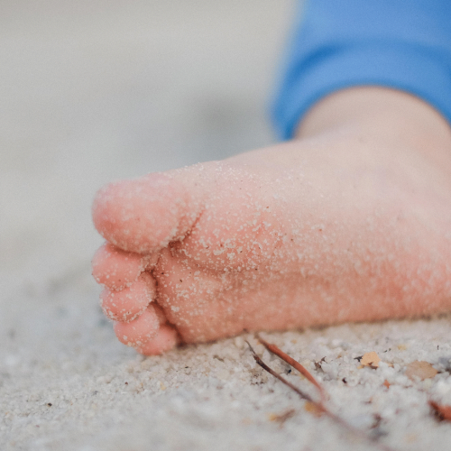Tale of Eczema