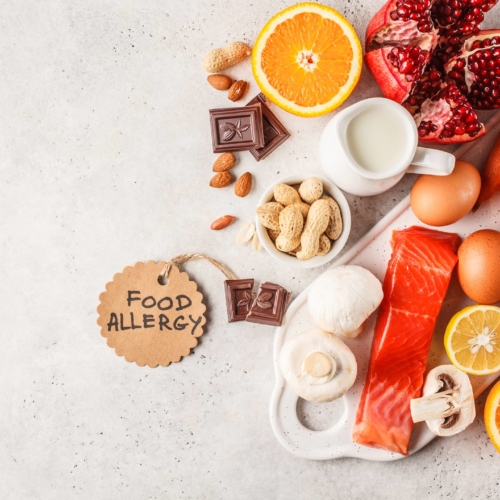 food-allergy-concept2160