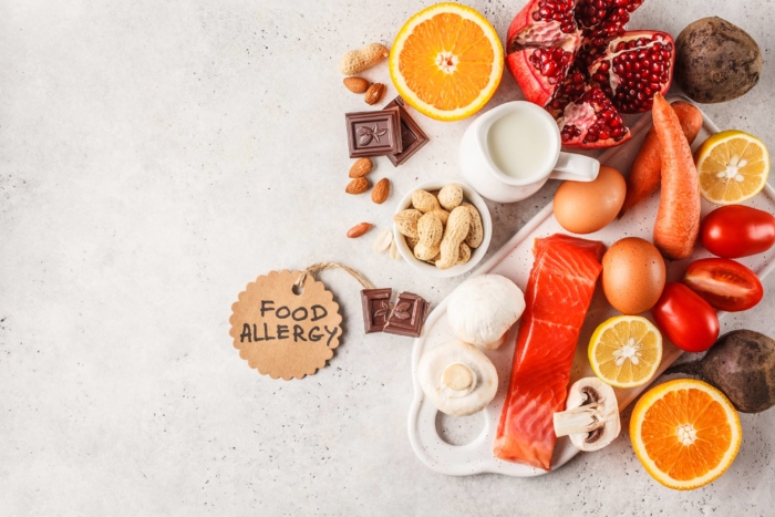 food-allergy-concept2160