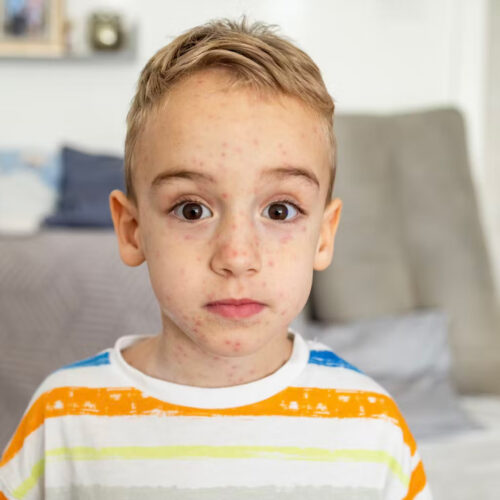 SBDIGIT/Getty Images